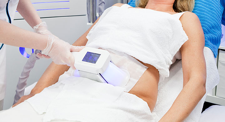 Cryo Slimming Treatment